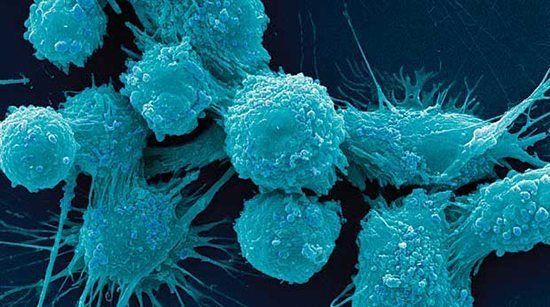 prostate_cells2